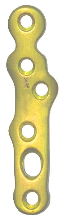 Пластина для артродезу 1-го плеснофалангового суглоба, кут 0, права, з кутовою стабільністю, титан